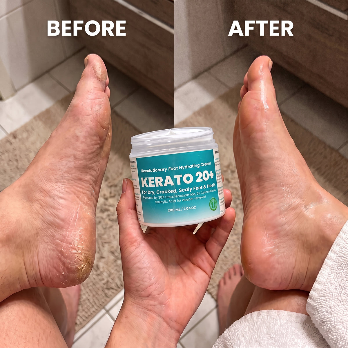 Urea 20% Intense Foot Hydrating Cream For Dry, & Cracked Feet, Non-Greasy