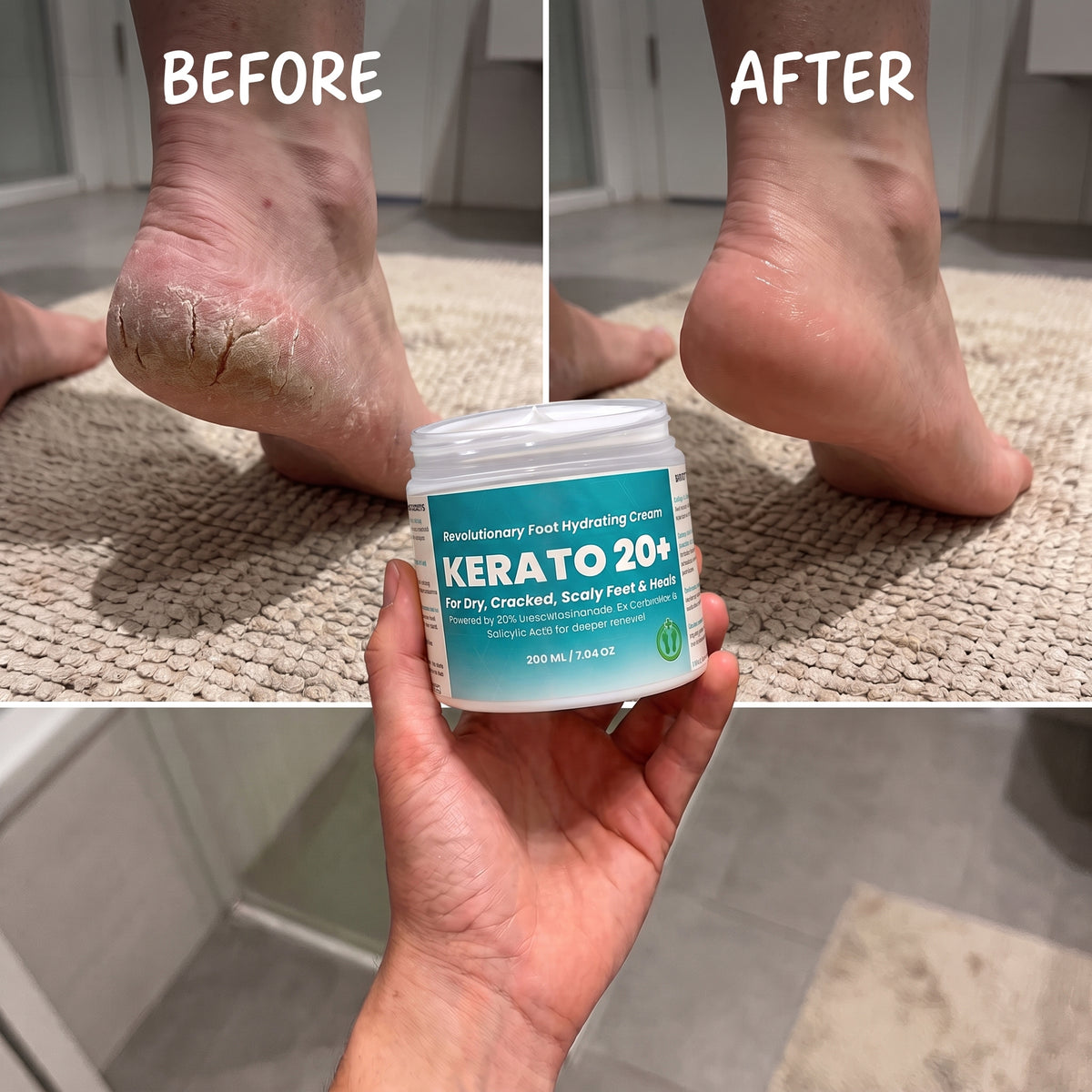 Urea 20% Intense Foot Hydrating Cream For Dry, & Cracked Feet, Non-Greasy